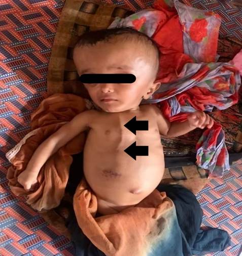 A baby lying on a blanket

AI-generated content may be incorrect.