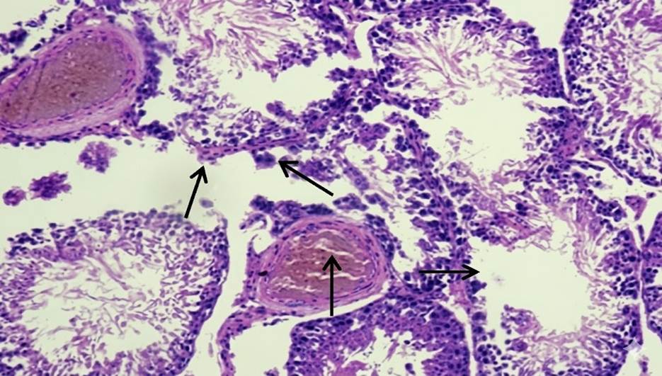 Microscopic Changes in Spleen and Testis of Male Albino Rats due to Exposure to Sodium Arsenate- an Experimental Study