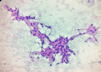 A purple and white cell

AI-generated content may be incorrect.