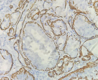 A close-up of a microscope

AI-generated content may be incorrect.