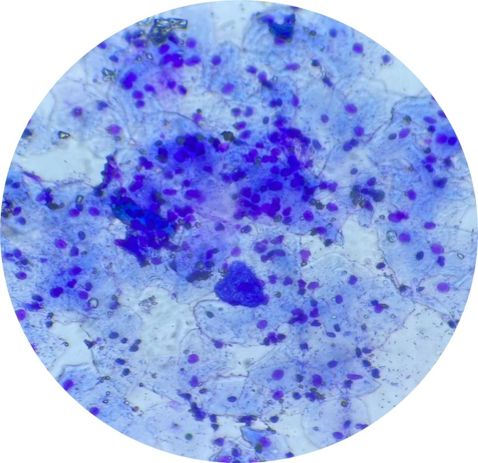 Cytological Detection and Seasonal Variation of Cervicovaginal Infections: A Two-Year Cross Sectional Observational Study from a Tertiary Care Centre